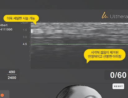 2배 더 커진 초음파 필드
